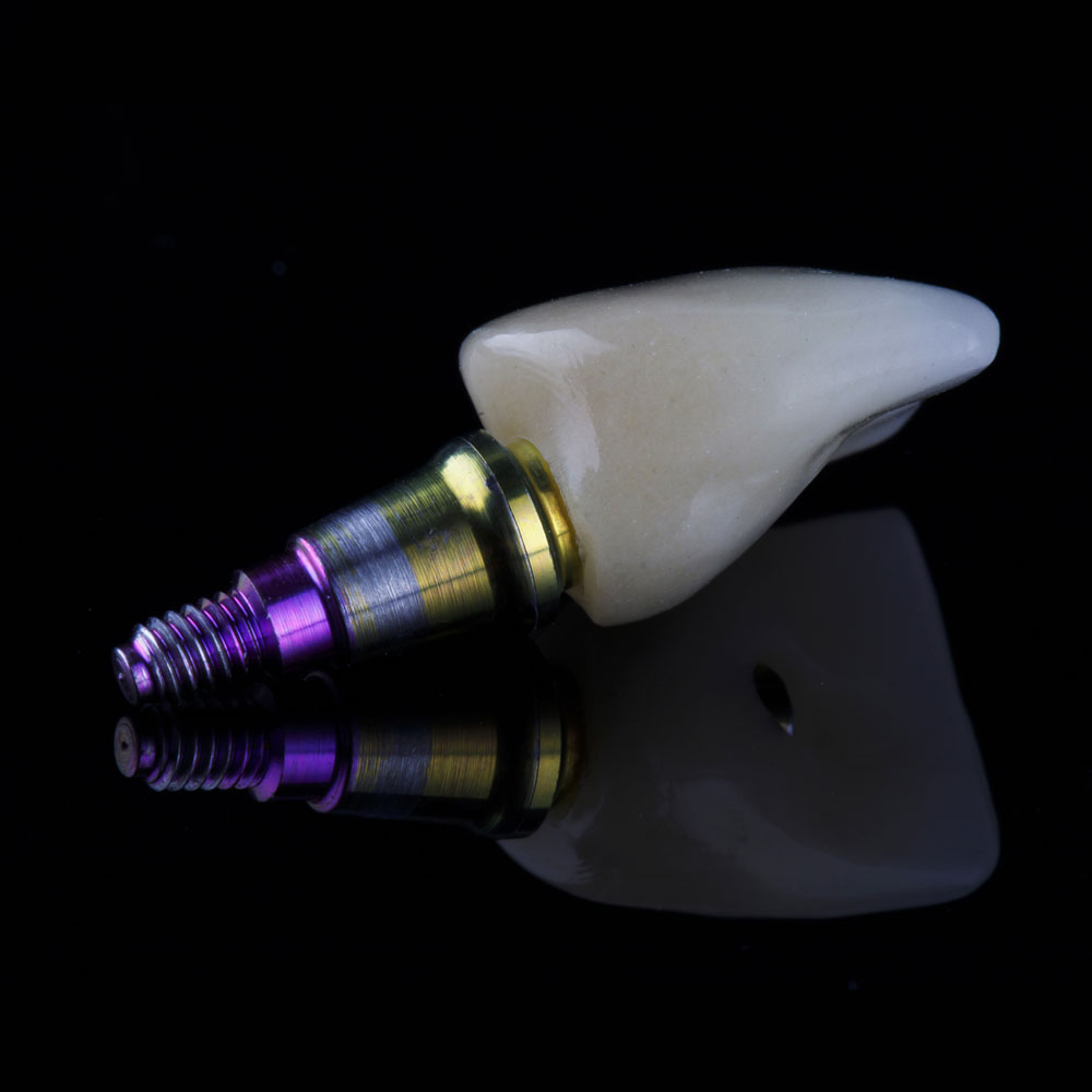 CalWest-Dental-Laboratories-Inc_services_implants-custom-abutments